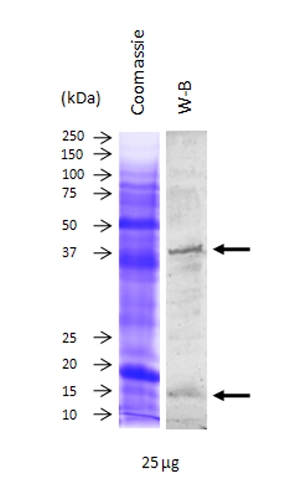 western blot using hen anti-Cu Zn SOD antibody